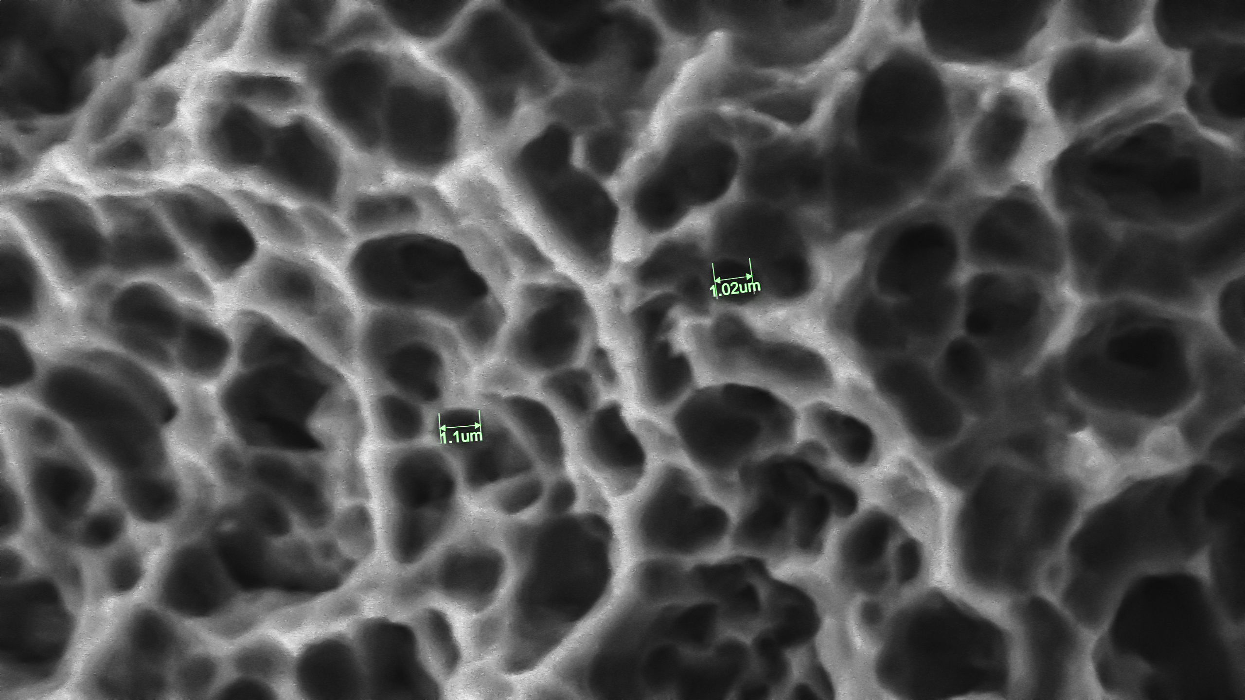 SuperSEM N10XL 在牙科种植体微观检测中的应用(图2)